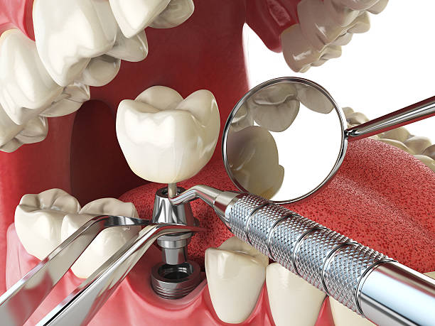 Best Emergency Gum Pain Relief  in Cincinnati, OH